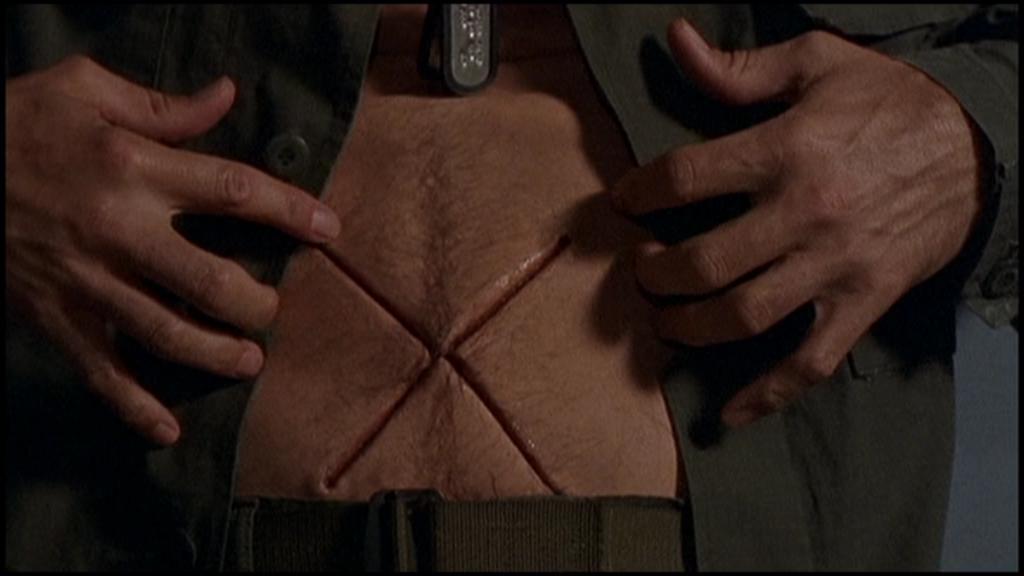 34
